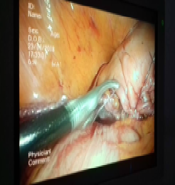 chirurgie urologique