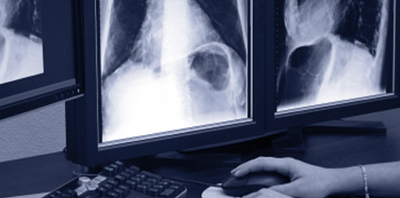 imagerie médicale